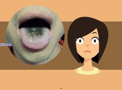 吃瓜尖舌头会黑,吃瓜尖舌头变黑之谜