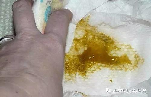 宝宝拉便便视频,揭秘宝宝肠道健康小秘密