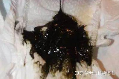 宝宝拉便便视频,揭秘宝宝肠道健康小秘密
