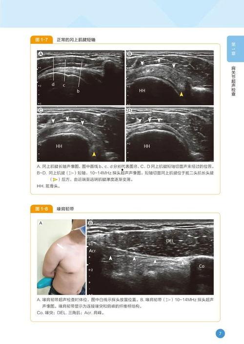 超声视频,捕捉生命律动的瞬间