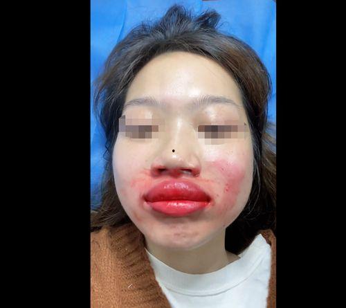 嘴唇视频,视频中的嘴唇故事
