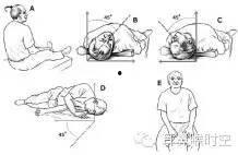 耳石复位法视频,轻松缓解眩晕，恢复平衡感
