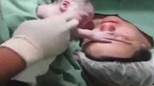 生宝宝难产视频,揭秘难产宝宝诞生的瞬间