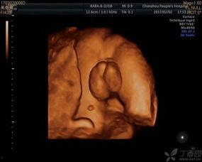 外生殖器检查视频,全面掌握临床技巧