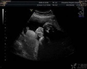 外生殖器检查视频,全面掌握临床技巧